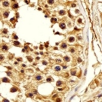 Anti-PSMA5 Antibody