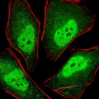 Anti-PSMA5 Antibody