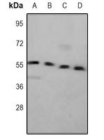 Calreticulin Mouse Monoclonal Antibody