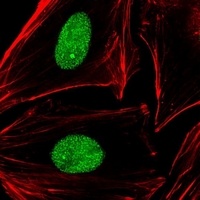APE1 Antibody