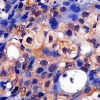 ERK1 Antibody [KO/KD Validated]