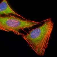 ERK1 Antibody [KO/KD Validated]