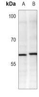 YY1 Antibody [KO/KD Validated]