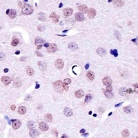 Anti-YY1 Antibody
