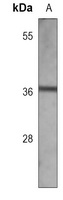 Cyclin D1 Mouse Monoclonal Antibody