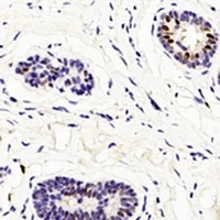 Anti-GATA3 Antibody