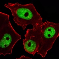 Anti-GATA3 Antibody