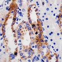 Anti-ME2 Antibody