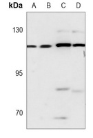 c-CBL Antibody