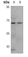 Acetylcholinesterase Antibody