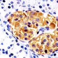 Anti-RAB3B Antibody
