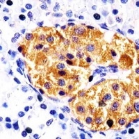 RAB3B antibody