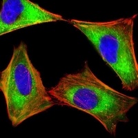 Anti-PKR Antibody