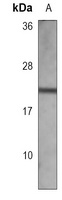 ADCYAP1 Antibody