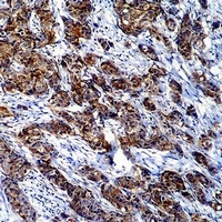 Galectin 3 antibody