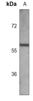 Desmin Mouse Monoclonal Antibody
