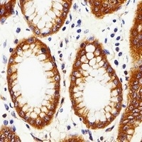 Calpain 2 Antibody