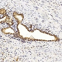 Anti-MGMT Antibody