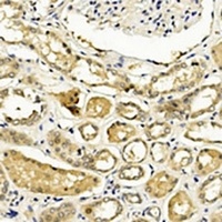 TIMP2 antibody