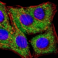 Anti-TIMP2 Antibody