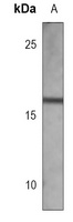 nm23-H1 Antibody