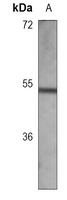 Arylsulfatase A Mouse Monoclonal Antibody