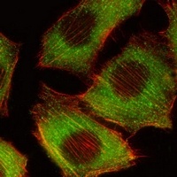 B-RAF Antibody