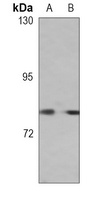 HGF Mouse Monoclonal Antibody