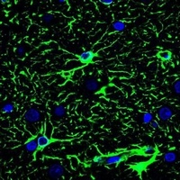 Anti-GFAP Antibody