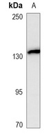 CD56 Antibody