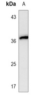 Nucleophosmin Mouse Monoclonal Antibody