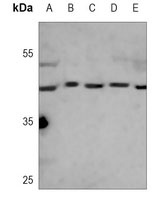 Creatine Kinase B Antibody [KO/KD Validated]