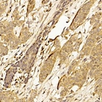 CDK4 Antibody [KO/KD Validated]