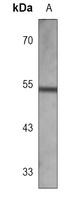 Cytochrome P450 2C9 Antibody