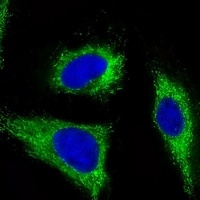 FGFR1 antibody