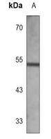 CaMK2 alpha Mouse Monoclonal Antibody