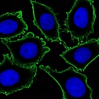 CD117 Antibody