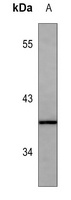 SPARC Antibody