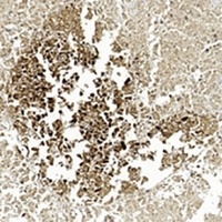 Gamma-enolase antibody