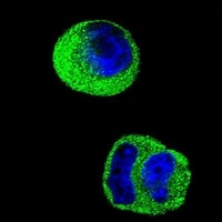 Anti-MMP2 Antibody