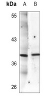 Synaptophysin Mouse Monoclonal Antibody