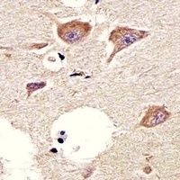 Anti-CHRM2 Antibody