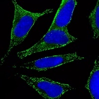 Anti-CHRM2 Antibody