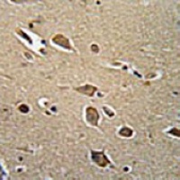 Anti-CD271 Antibody