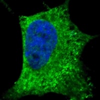 Anti-CD271 Antibody