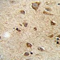 Anti-RET Antibody