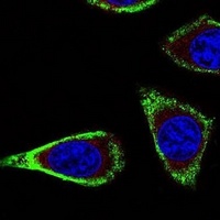 Anti-RET Antibody