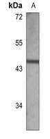 Cathepsin D Antibody