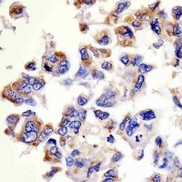 Cathepsin D Antibody