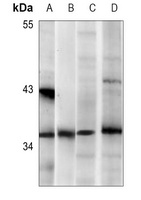 Nucleophosmin Antibody